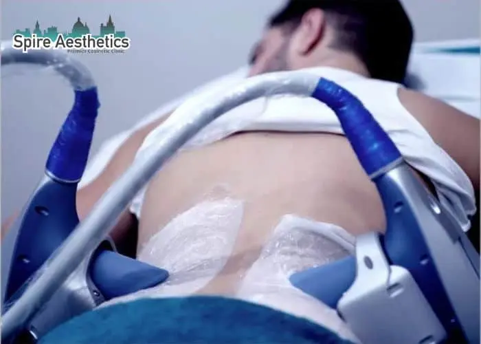Man having fat freezing treatment done on love handles before a competitions Chard to create a sculpted look.